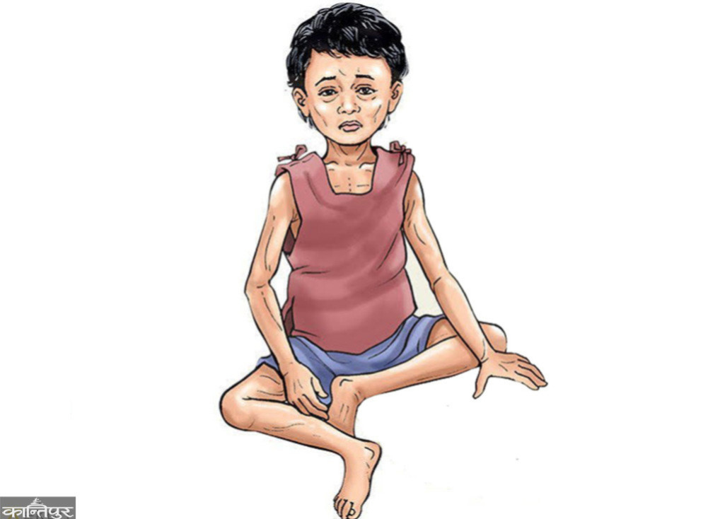 Malnutrition in Chepang, 4 children died since July