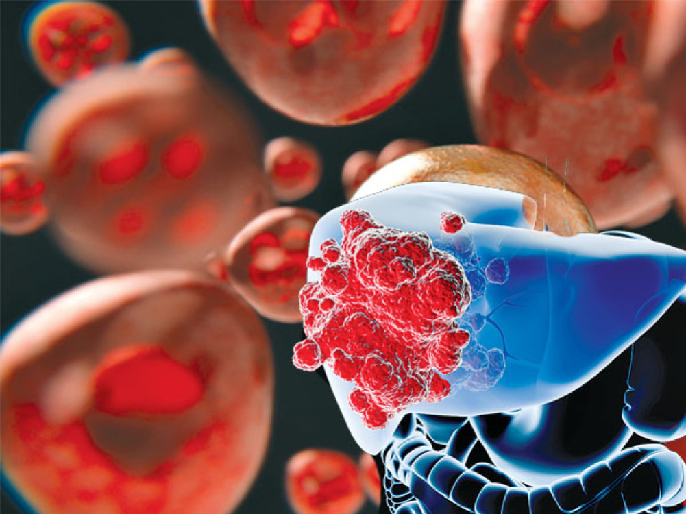 Give courage, not sympathy, to cancer patients