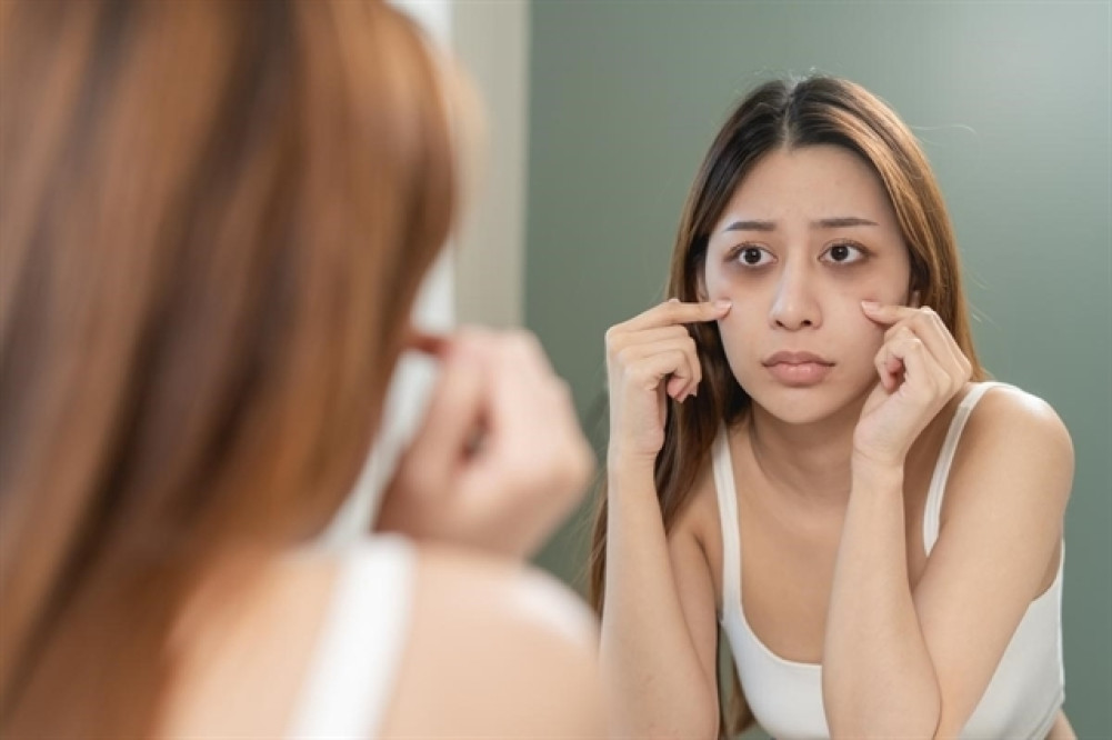 Did you see the 'dark circle'? There are preventive measures