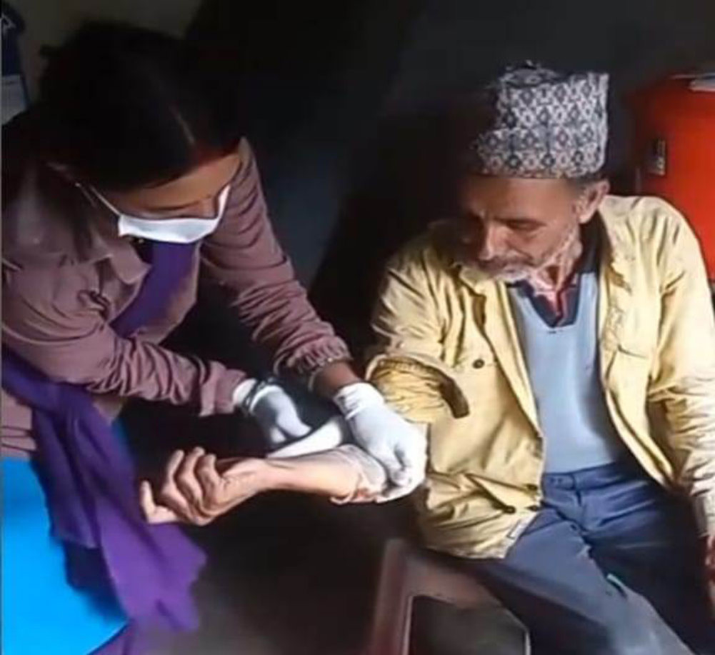 Four injured in jackal attack in Darchula