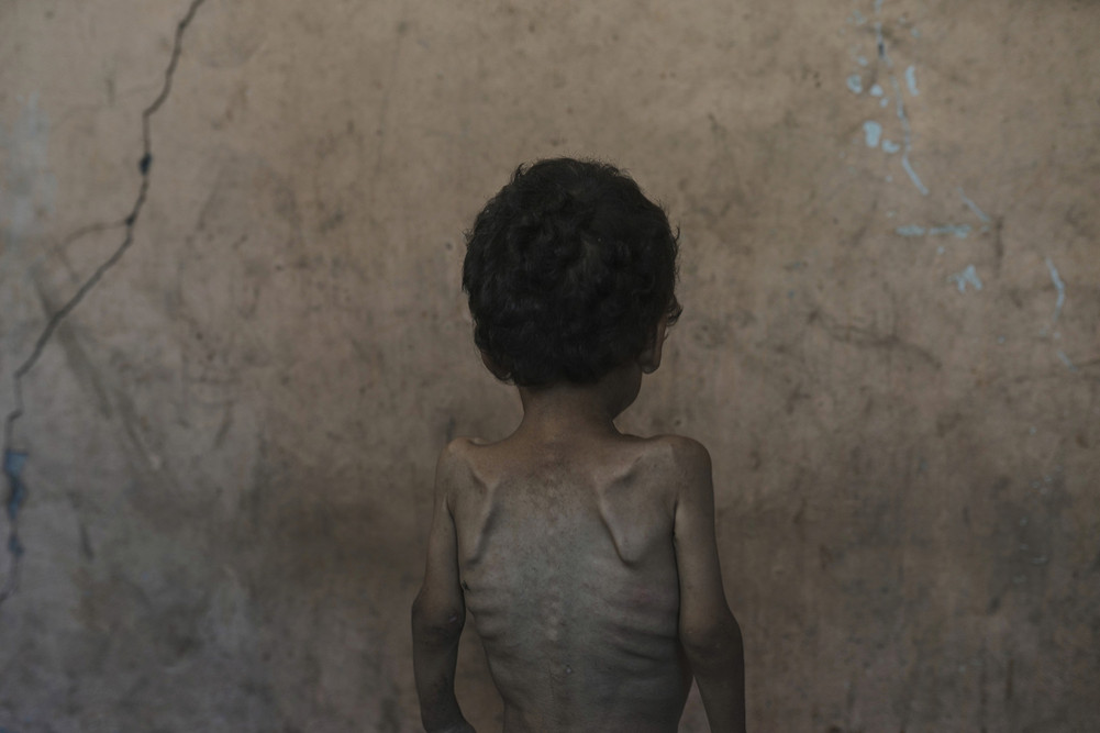 Food crisis expert warns: 'Worst famine' in Gaza
