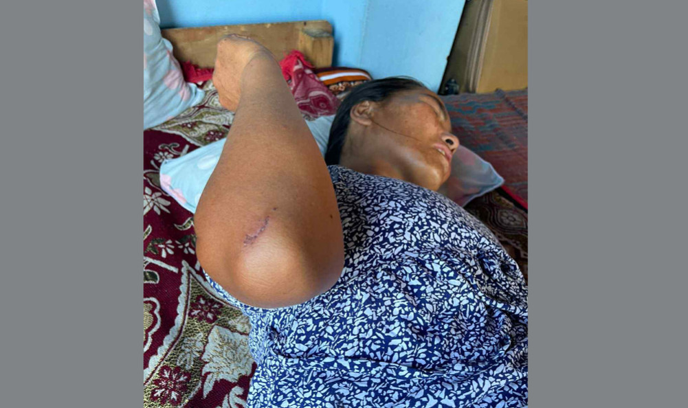 The condition of the woman who was attacked by the group was serious, she was returned home after pressure to reconcile