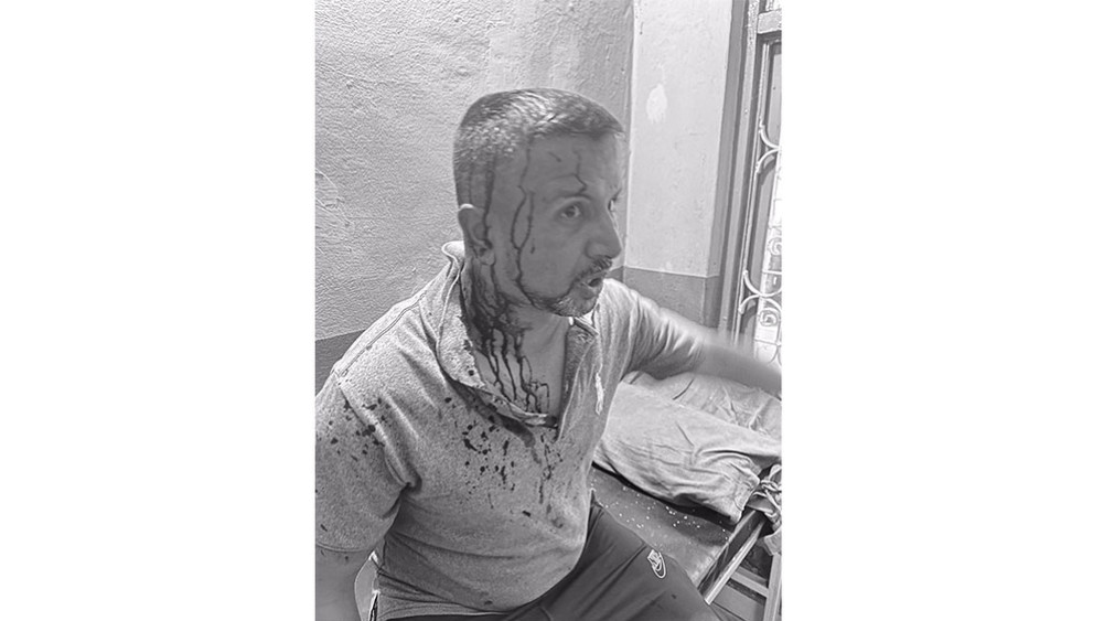 Clash between two factions of UML in the mountains. State member Poudel's head split