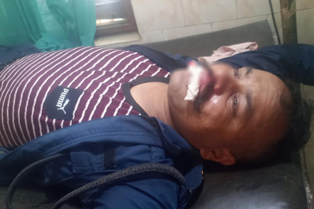 Clashes between locals and police in Gulariya, 11 policemen injured