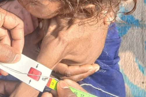 More than 200,000 children under the age of five suffer from severe malnutrition