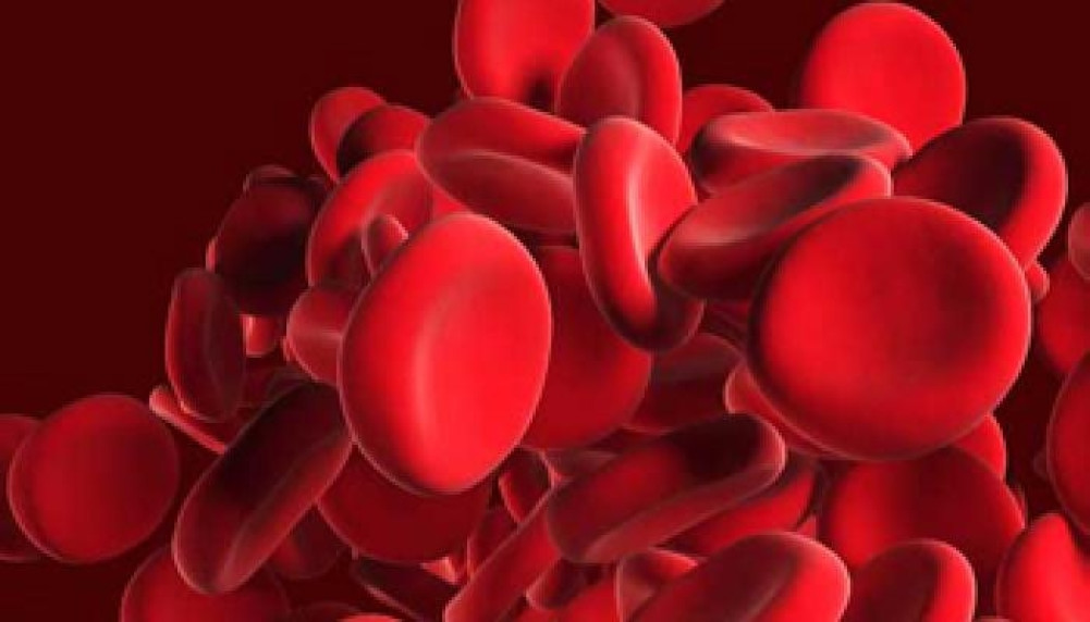 Sickle cell disease is becoming a challenge for the health sector
